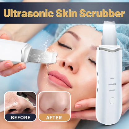 Ultrasonic Skin Scrubber Ance Pore Cleaner Peeling Blackhead Remover Deep Face Cleaning Ultrasonic Ion Facial Shovel Cleanser