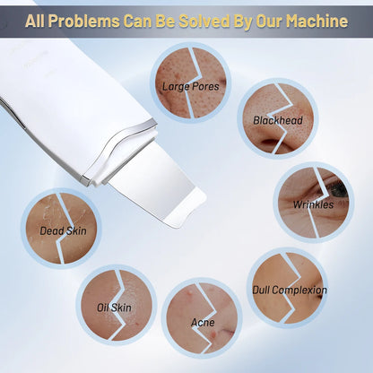 Ultrasonic Skin Scrubber Ance Pore Cleaner Peeling Blackhead Remover Deep Face Cleaning Ultrasonic Ion Facial Shovel Cleanser