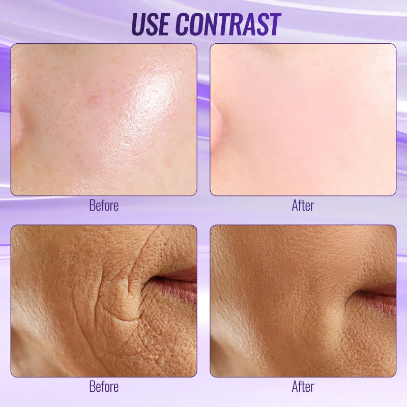 2025 Dual Mode High Frequency Wand - Orange (Argon) for Acne/Purple (Neon) for Firming Professional Home Spa Device New 6-in-1